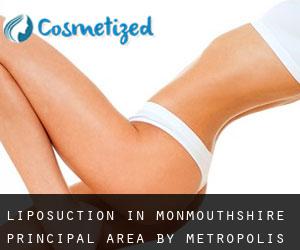 Liposuction in Monmouthshire principal area by metropolis - page 1