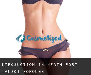 Liposuction in Neath Port Talbot (Borough)