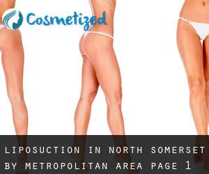 Liposuction in North Somerset by metropolitan area - page 1