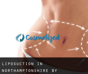 Liposuction in Northamptonshire by municipality - page 2