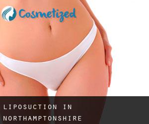 Liposuction in Northamptonshire