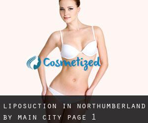 Liposuction in Northumberland by main city - page 1