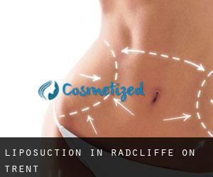 Liposuction in Radcliffe on Trent
