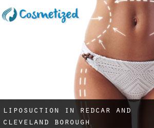 Liposuction in Redcar and Cleveland (Borough)