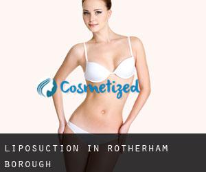 Liposuction in Rotherham (Borough)