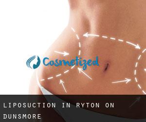 Liposuction in Ryton on Dunsmore