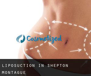 Liposuction in Shepton Montague