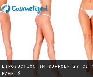 Liposuction in Suffolk by city - page 3