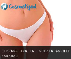 Liposuction in Torfaen (County Borough)