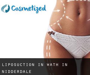 Liposuction in Wath-in-Nidderdale