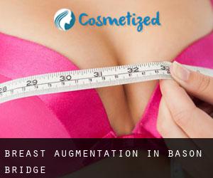 Breast Augmentation in Bason Bridge