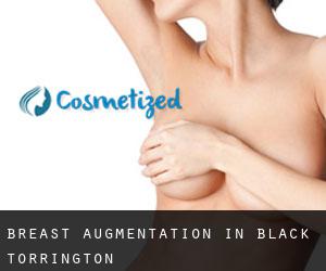 Breast Augmentation in Black Torrington