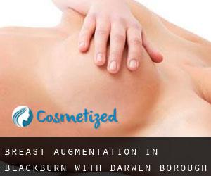 Breast Augmentation in Blackburn with Darwen (Borough)