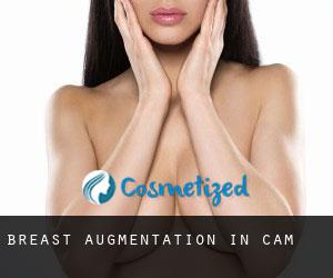 Breast Augmentation in Cam