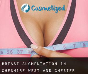 Breast Augmentation in Cheshire West and Chester