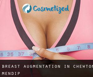 Breast Augmentation in Chewton Mendip