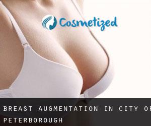 Breast Augmentation in City of Peterborough