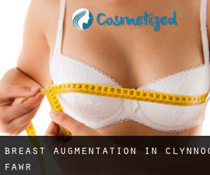 Breast Augmentation in Clynnog-fawr