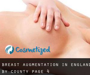 Breast Augmentation in England by County - page 4
