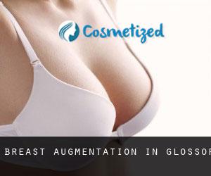 Breast Augmentation in Glossop Breast Augmentation in Glossop