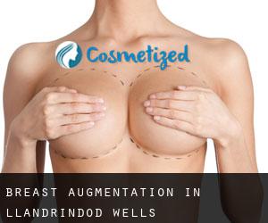 Breast Augmentation in Llandrindod Wells