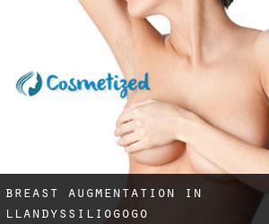 Breast Augmentation in Llandyssiliogogo