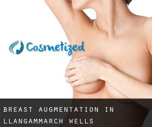 Breast Augmentation in Llangammarch Wells