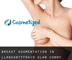 Breast Augmentation in Llansantffraid Glan Conwy