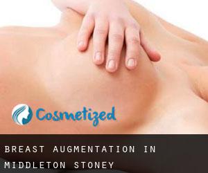 Breast Augmentation in Middleton Stoney