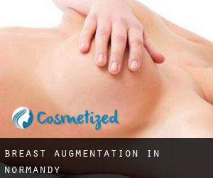Breast Augmentation in Normandy