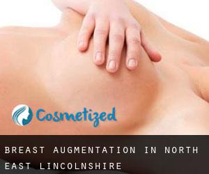 Breast Augmentation in North East Lincolnshire