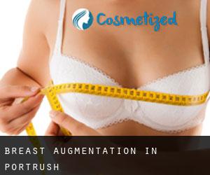 Breast Augmentation in Portrush Breast Augmentation in Portrush