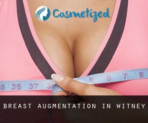 Breast Augmentation in Witney Breast Augmentation in Witney