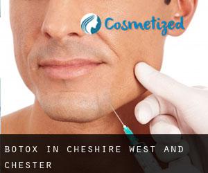 Botox in Cheshire West and Chester
