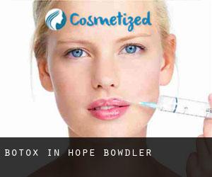 Botox in Hope Bowdler