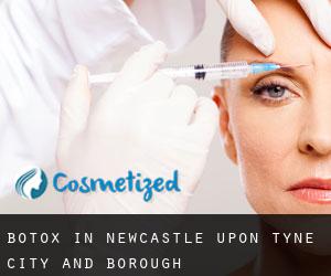 Botox in Newcastle upon Tyne (City and Borough)