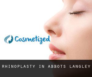 Rhinoplasty in Abbots Langley