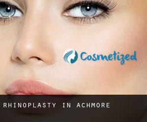 Rhinoplasty in Achmore