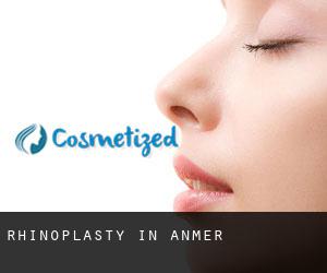 Rhinoplasty in Anmer Rhinoplasty in Anmer