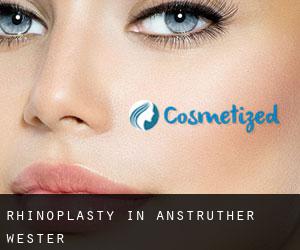Rhinoplasty in Anstruther Wester