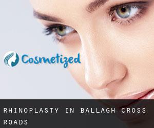 Rhinoplasty in Ballagh Cross Roads