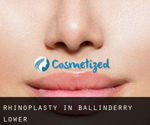 Rhinoplasty in Ballinderry Lower Rhinoplasty in Ballinderry Lower