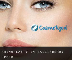 Rhinoplasty in Ballinderry Upper Rhinoplasty in Ballinderry Upper