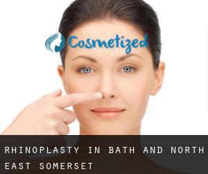 Rhinoplasty in Bath and North East Somerset Rhinoplasty in Bath and North East Somerset