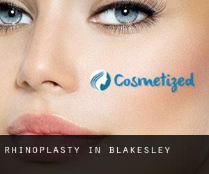 Rhinoplasty in Blakesley