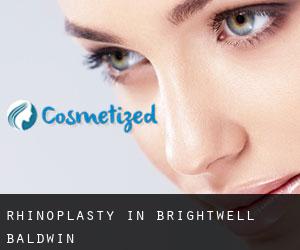 Rhinoplasty in Brightwell Baldwin