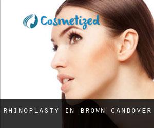 Rhinoplasty in Brown Candover