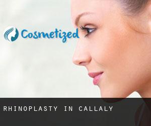 Rhinoplasty in Callaly