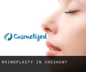 Rhinoplasty in Cheshunt Rhinoplasty in Cheshunt