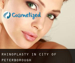 Rhinoplasty in City of Peterborough